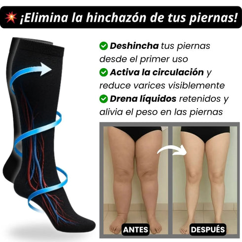 Medias de Compresión Antidolor (23-32mmHg) - Alivio Varices e Hinchazón